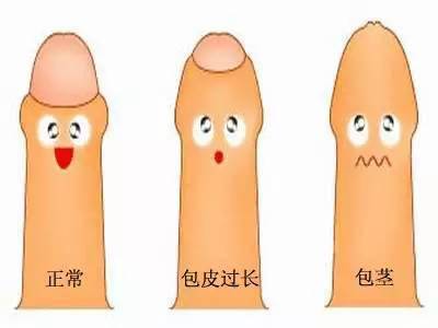 做完雙眼皮手術(shù)注意事項(xiàng)有哪些,做完人流后注意事項(xiàng),做完光子嫩膚后注意事項(xiàng)