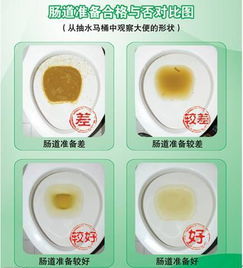 甘露腸鏡檢查前注意事項(xiàng)