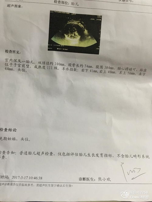 破腹產(chǎn)第一天注意事項