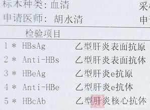 乙肝,五項,注意事項,檢查