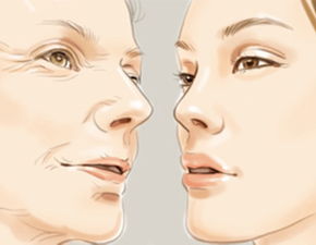 眼部打除皺針注意事項(xiàng)