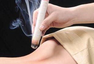 艾灸肚臍眼注意事項