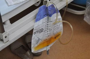 女老人導(dǎo)尿注意事項