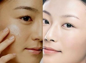 做過(guò)果酸后注意事項(xiàng),果酸做完注意事項(xiàng),用果酸釣魚(yú)注意事項(xiàng)