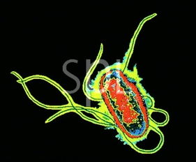 大腸桿菌感受態(tài)細(xì)胞的制備的注意事項(xiàng),大腸桿菌滅活疫苗的制備注意事項(xiàng),大腸桿菌感受態(tài)細(xì)胞的制備與轉(zhuǎn)化注意事項(xiàng)