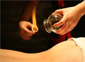 拔火罐禁忌和注意事項