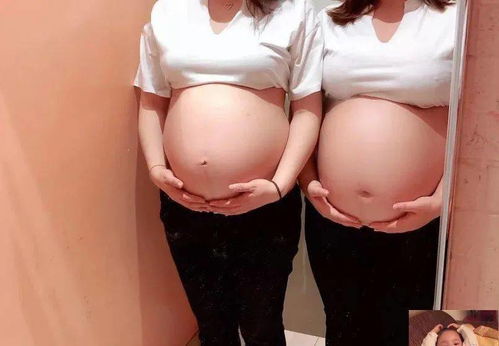 24周孕檢注意事項(xiàng)