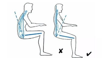 手術(shù)后需要注意事項(xiàng),手術(shù)前需要注意事項(xiàng),駝背穿衣服要注意事項(xiàng)