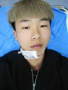 打美容針后注意事項有哪些,縫完美容針的注意事項,下巴縫了美容針注意事項