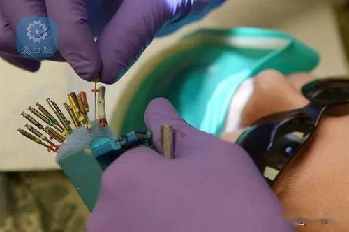 根管預(yù)備機(jī)擴(kuò)使用的注意事項(xiàng)