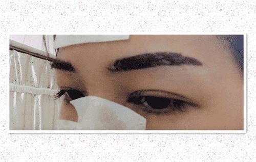 注意事項,輕氧眉掉痂后