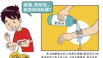 打了狂犬疫苗的注意事項