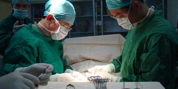 包皮,手術(shù)后,注意事項(xiàng),男人