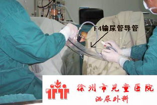 膀胱沖洗的操作流程及注意事項(xiàng),膀胱沖洗的目的及注意事項(xiàng),持續(xù)膀胱沖洗的護(hù)理及注意事項(xiàng)