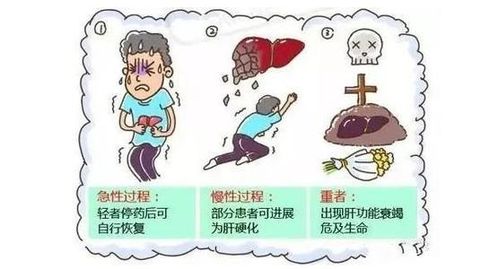 肝損傷恢復(fù)后注意事項