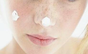 激光治療雀斑后的注意事項