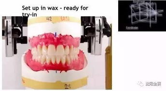 上頜架的注意事項(xiàng)有哪些,上頜架的注意事項(xiàng)中正確的是,上頜架的注意事項(xiàng)中錯(cuò)誤的是