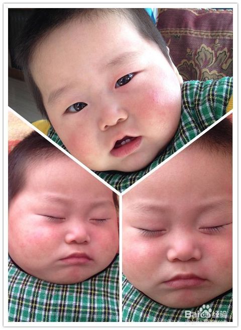 風(fēng)疹,注意事項(xiàng),幼兒