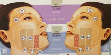 超聲刀操作注意事項