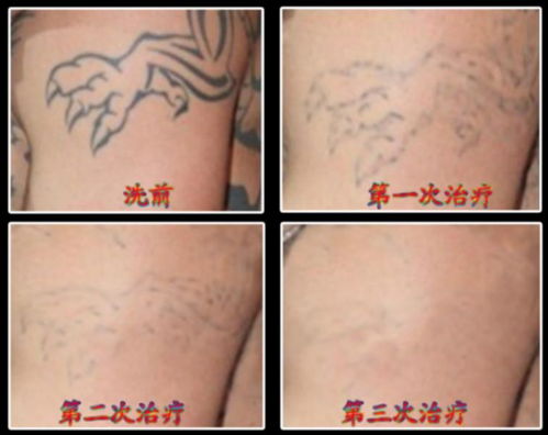 紋身,注意事項(xiàng)