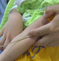 輸液后拔針注意事項