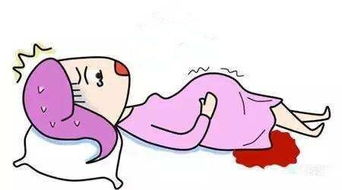 引產(chǎn)后注意事項有哪些