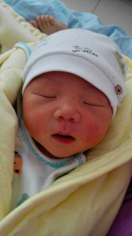 破腹產(chǎn)坐月子注意事項,破腹產(chǎn)術(shù)后注意事項,破腹產(chǎn)注意事項和流程