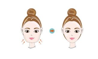 要注意,面部,抽脂,事項