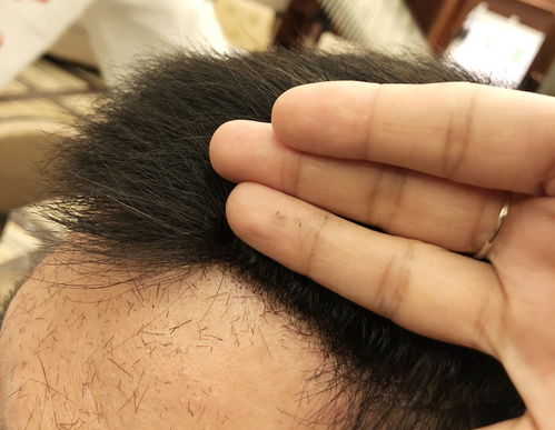 注意事項,整膠頂