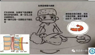 麻醉科,鎮(zhèn)痛,注意事項