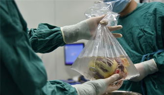 換心,術(shù)后,注意事項,手術(shù)