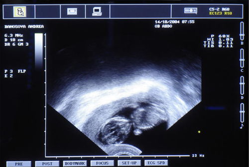 超前,陰道,注意事項(xiàng)