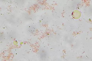 不染色標(biāo)本觀察注意事項(xiàng)