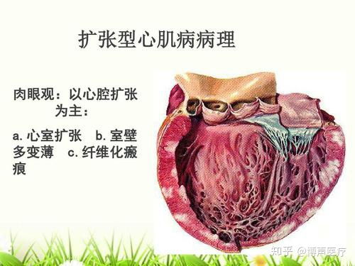 心臟球囊擴(kuò)張術(shù)后注意事項(xiàng),心臟支架術(shù)后注意事項(xiàng),心臟支架十大注意事項(xiàng)