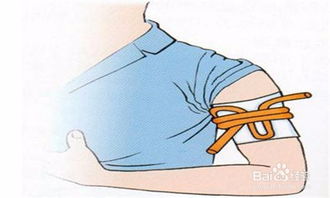 止血帶,簡(jiǎn)述,注意事項(xiàng)