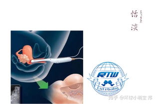 試管嬰兒取卵前后注意事項