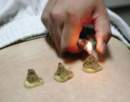 隔姜灸的操作方法和注意事項(xiàng),隔姜灸的禁忌癥和注意事項(xiàng),隔姜灸的目的及注意事項(xiàng)