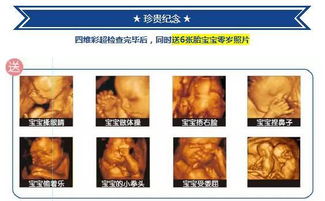 做肝臟彩超的注意事項,做彩超的注意事項,做彩超檢查注意事項