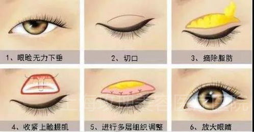 矯正,注意事項(xiàng),眼睛