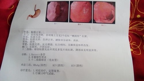 兒童胃鏡注意事項(xiàng)