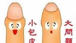 割包皮后的注意事項(xiàng)有哪些