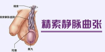 精索靜脈曲張手術(shù)后要注意什么,精索鞘膜積液手術(shù)后注意事項,精索手術(shù)術(shù)后注意事項