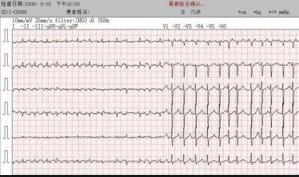 阿托品,注意事項(xiàng),試驗(yàn)