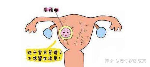 子宮癌的飲食注意事項