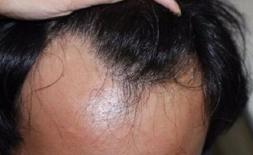 植發(fā)前后要注意什么,染頭發(fā)前后注意事項(xiàng),燙頭發(fā)前后注意事項(xiàng)