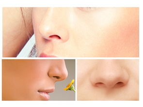 整鼻子術后注意事項,鼻子手術后注意事項,整完鼻子注意事項