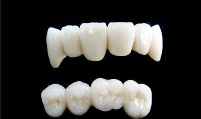 烤瓷牙之后需要注意事項(xiàng)