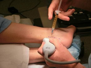 局部封閉治療后注意事項,封閉藥除草劑注意事項,水稻封閉藥的注意事項