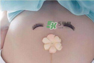 疤痕體質刨腹產(chǎn)注意事項