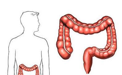 得直腸癌手術(shù)后的注意事項(xiàng)